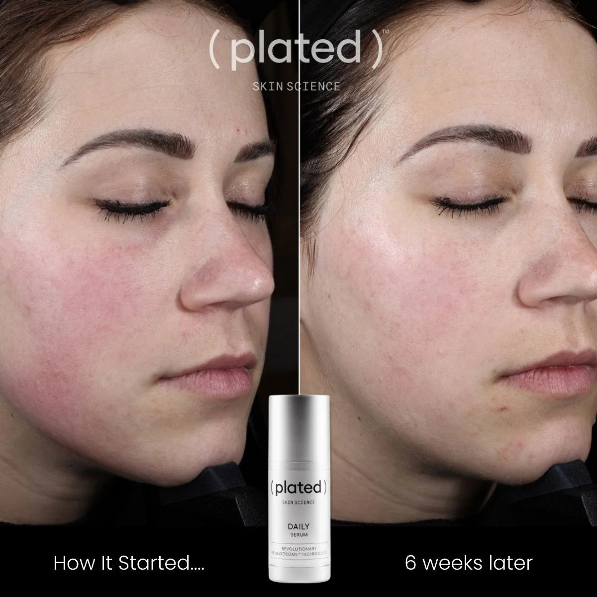 plated™ DAILY Serum